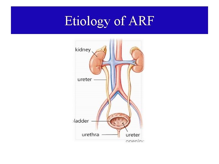Etiology of ARF 