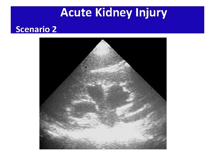 Acute Kidney Injury Scenario 2 