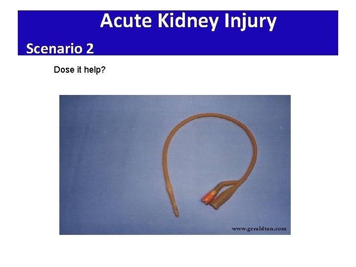 Acute Kidney Injury Scenario 2 Dose it help? 