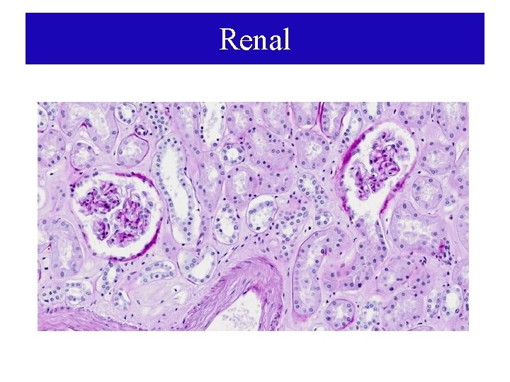 Renal 