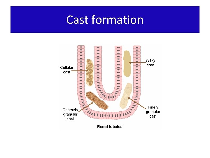 Cast formation 