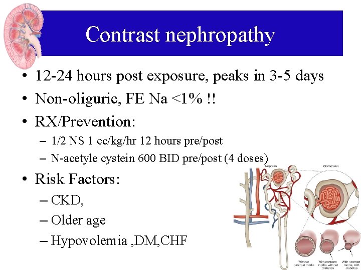 Contrast nephropathy • 12 -24 hours post exposure, peaks in 3 -5 days •