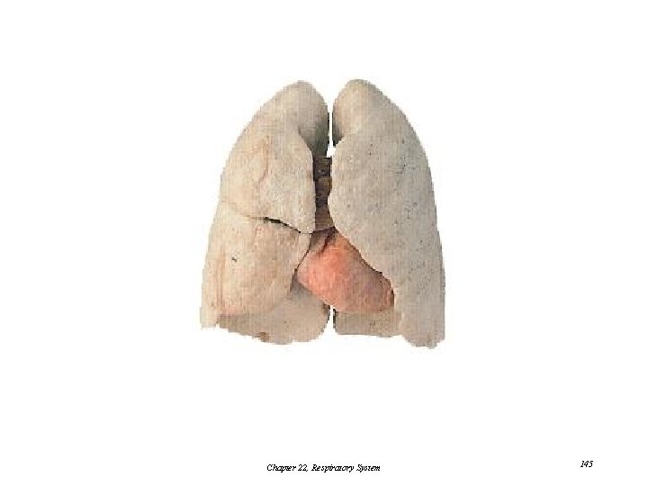 Chapter 22, Respiratory System 145 