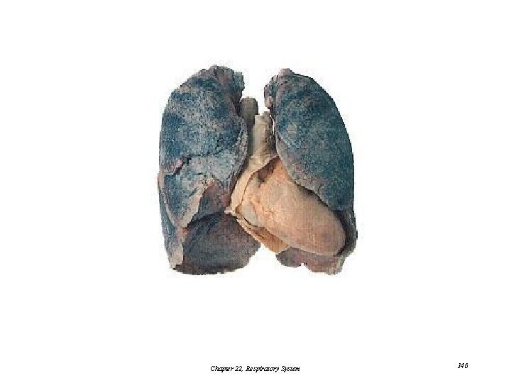 Chapter 22, Respiratory System 146 