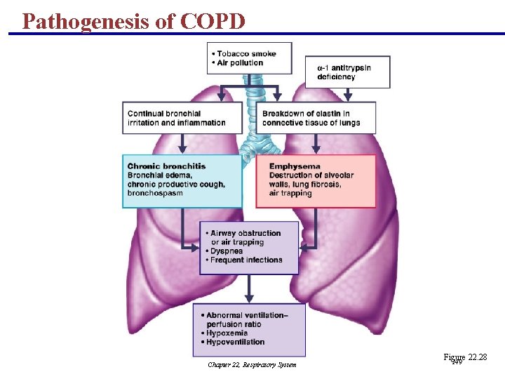 Pathogenesis of COPD Chapter 22, Respiratory System Figure 22. 28 149 