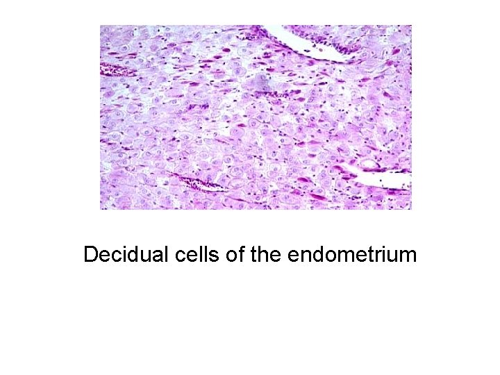 Decidual cells of the endometrium 