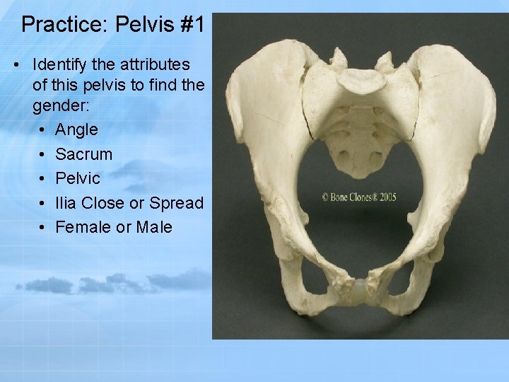 Practice: Pelvis #1 • Identify the attributes of this pelvis to find the gender: