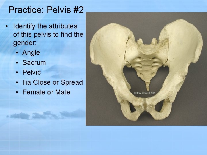 Practice: Pelvis #2 • Identify the attributes of this pelvis to find the gender: Practice: Pelvis #2 • Identify the attributes of this pelvis to find the gender: