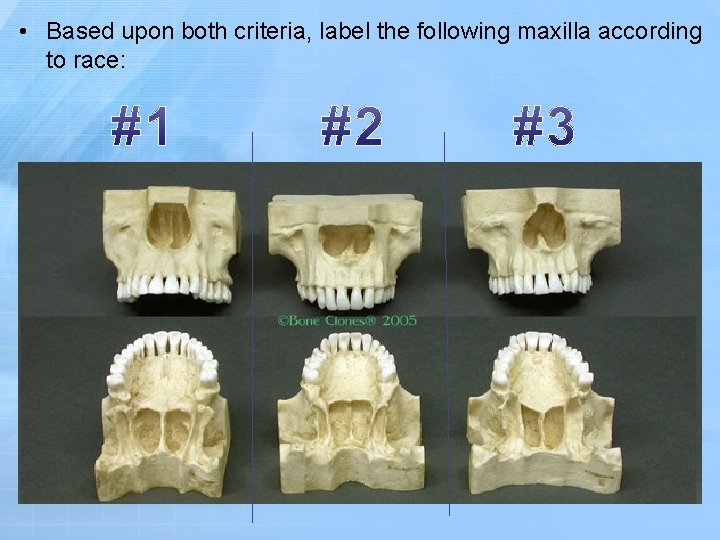  • Based upon both criteria, label the following maxilla according to race: 