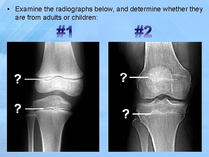  • Examine the radiographs below, and determine whether they are from adults or