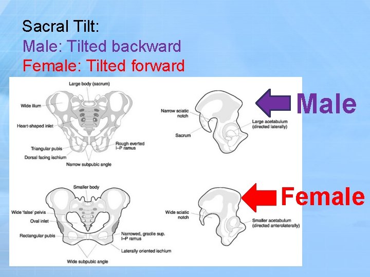 Sacral Tilt: Male: Tilted backward Female: Tilted forward Male Female 