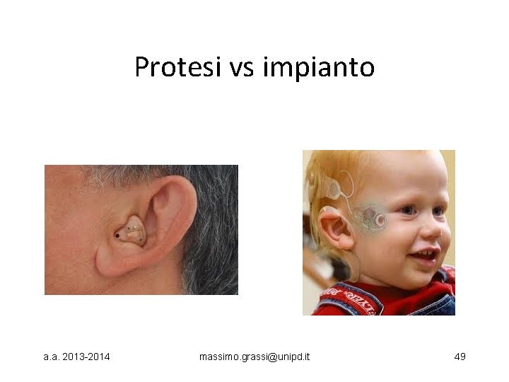 Protesi vs impianto a. a. 2013 -2014 massimo. grassi@unipd. it 49 