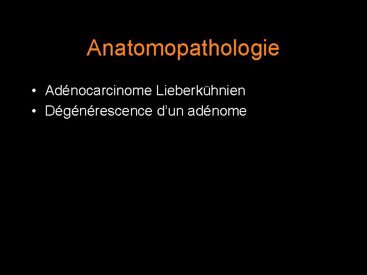 Anatomopathologie • Adénocarcinome Lieberkühnien • Dégénérescence d’un adénome 