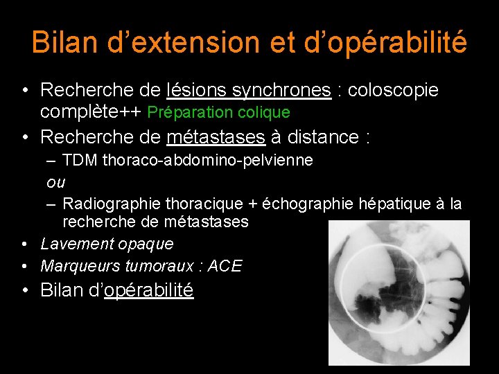 Bilan d’extension et d’opérabilité • Recherche de lésions synchrones : coloscopie complète++ Préparation colique