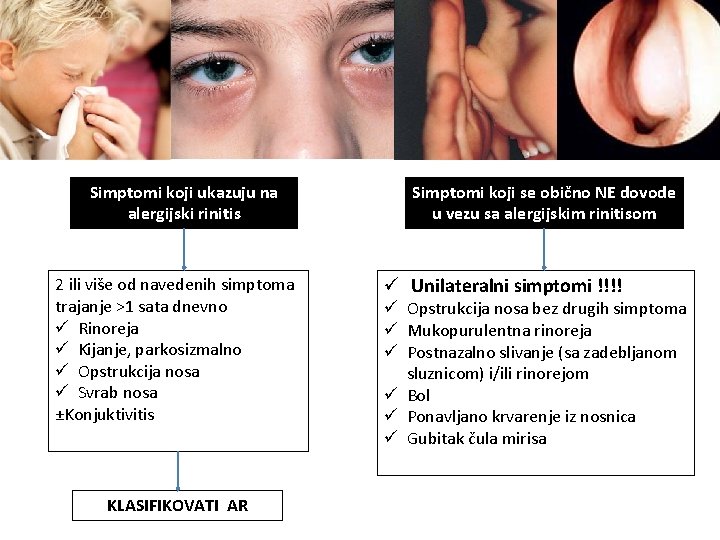 Simptomi koji ukazuju na alergijski rinitis 2 ili više od navedenih simptoma trajanje >1