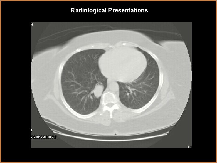 Radiological Presentations 