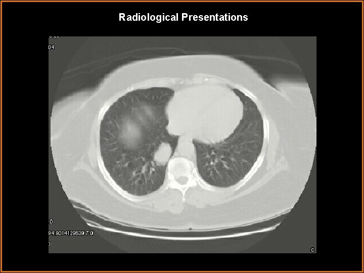 Radiological Presentations 