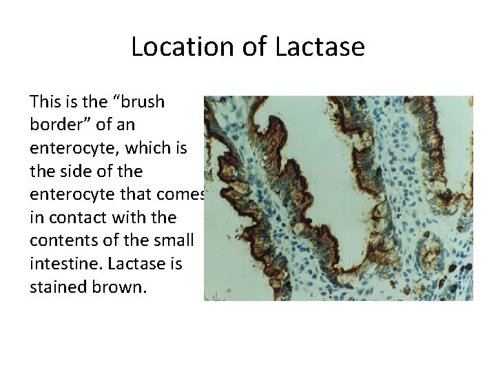 Location of Lactase This is the “brush border” of an enterocyte, which is the