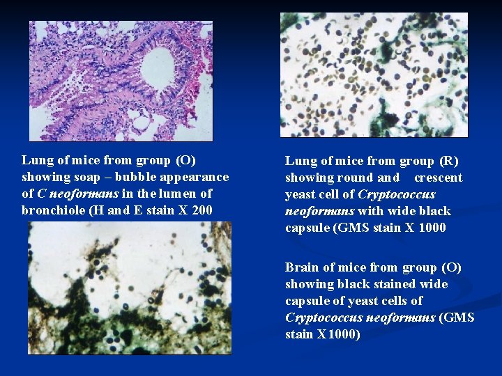 Lung of mice from group (O) showing soap – bubble appearance of C neoformans Lung of mice from group (O) showing soap – bubble appearance of C neoformans