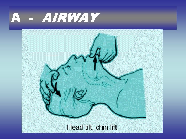 A - AIRWAY 