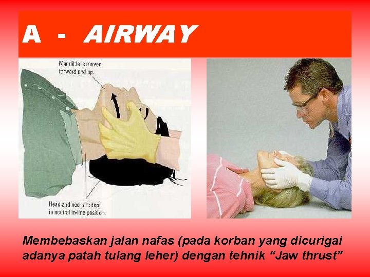 A - AIRWAY Membebaskan jalan nafas (pada korban yang dicurigai adanya patah tulang leher)