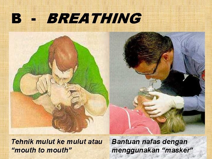 B - BREATHING Tehnik mulut ke mulut atau “mouth to mouth” Bantuan nafas dengan