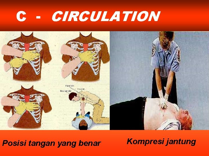 C - CIRCULATION Posisi tangan yang benar Kompresi jantung 