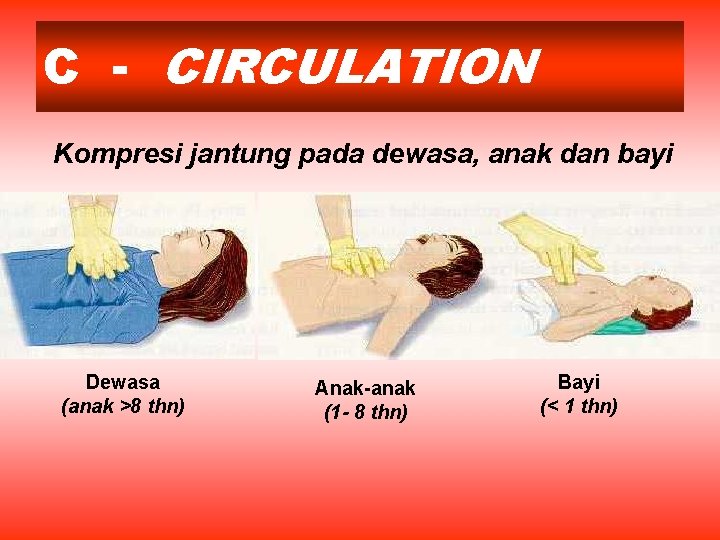 C - CIRCULATION Kompresi jantung pada dewasa, anak dan bayi Dewasa (anak >8 thn)