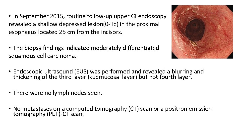  • In September 2015, routine follow-up upper GI endoscopy revealed a shallow depressed