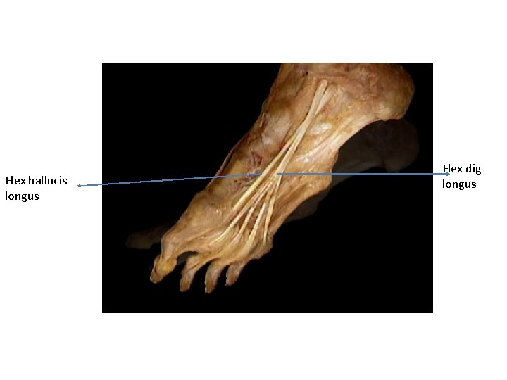 Flex hallucis longus Flex dig longus 