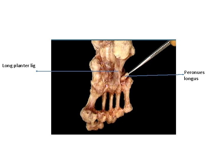 Long planter lig Peronues longus 