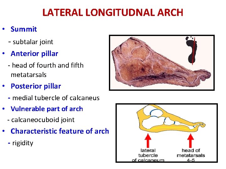 LATERAL LONGITUDNAL ARCH • Summit - subtalar joint • Anterior pillar - head of