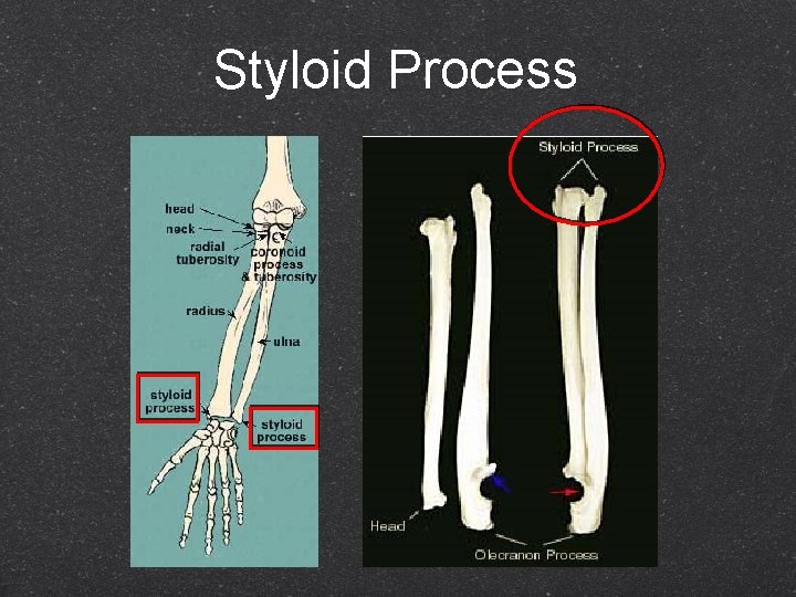 Styloid Process 