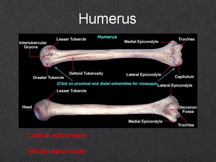 Humerus Lateral epicondyle Medial epicondyle 