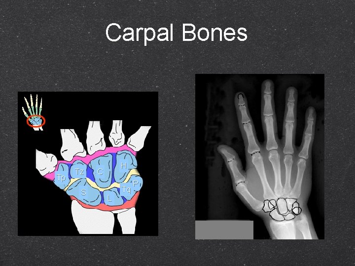 Carpal Bones Tp Tz S H C L Tq P 