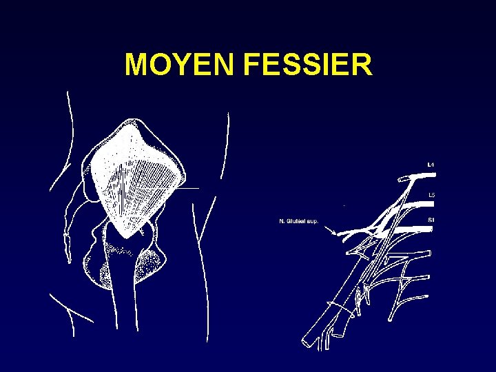 MOYEN FESSIER 