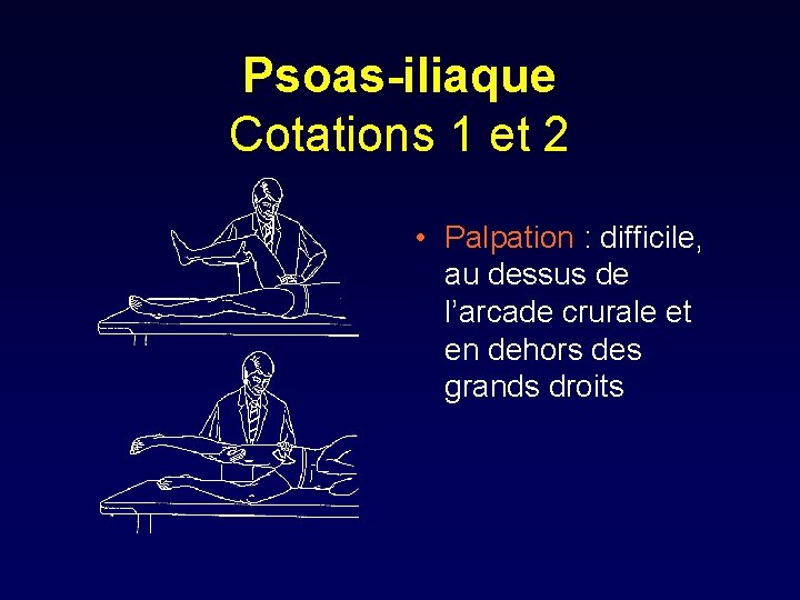 Psoas-iliaque Cotations 1 et 2 • Palpation : difficile, au dessus de l’arcade crurale