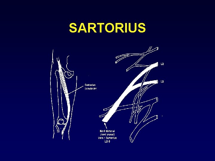 SARTORIUS 