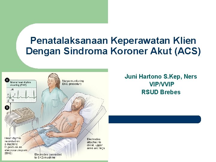 Penatalaksanaan Keperawatan Klien Dengan Sindroma Koroner Akut (ACS) Juni Hartono S. Kep, Ners VIP/VVIP