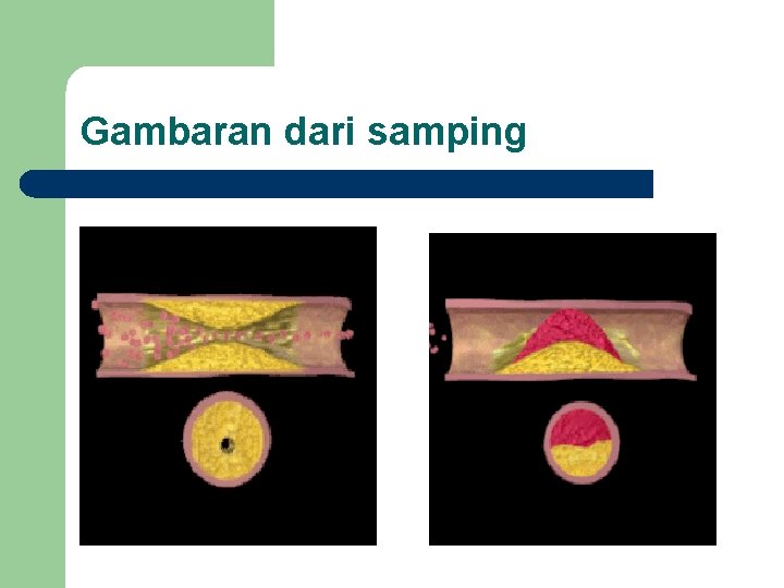 Gambaran dari samping 