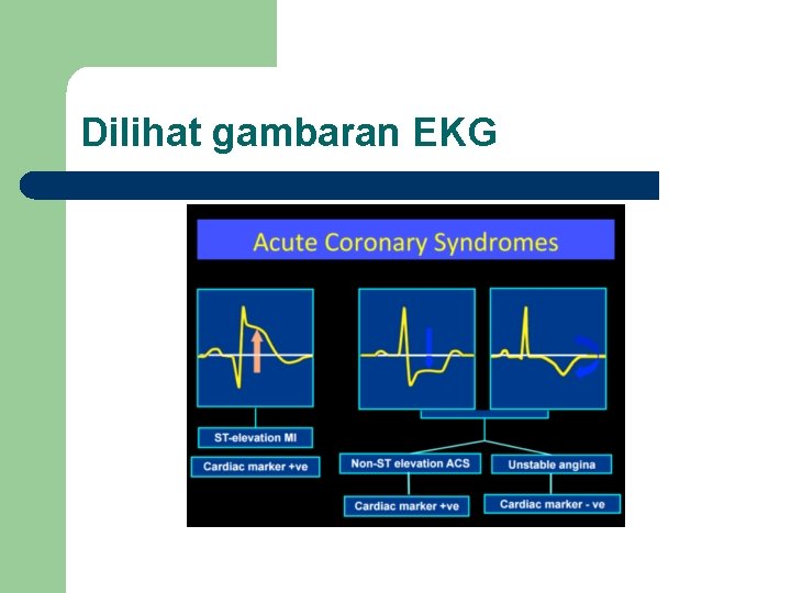 Dilihat gambaran EKG 