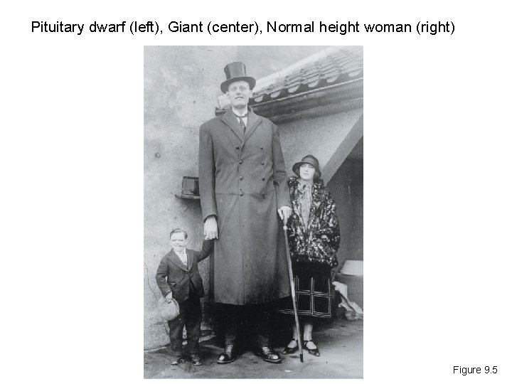 Pituitary dwarf (left), Giant (center), Normal height woman (right) Figure 9. 5 