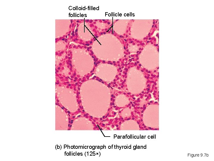 Colloid-filled Follicle cells follicles Parafollicular cell (b) Photomicrograph of thyroid gland follicles (125×) Figure