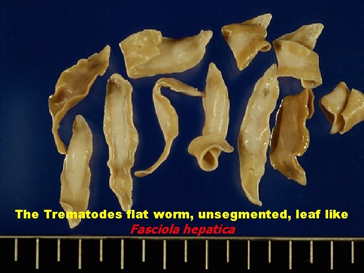 The Trematodes flat worm, unsegmented, leaf like Fasciola hepatica The Trematodes flat worm, unsegmented, leaf like Fasciola hepatica
