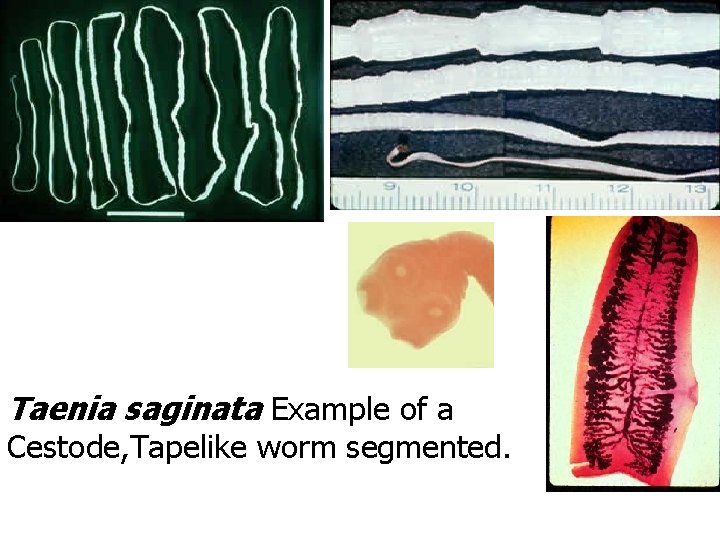 Taenia saginata Example of a Cestode, Tapelike worm segmented. Taenia saginata Example of a Cestode, Tapelike worm segmented.