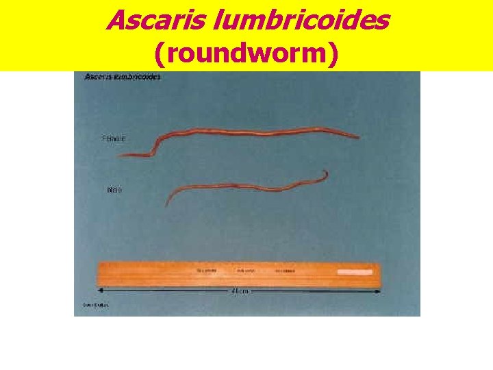 Ascaris lumbricoides (roundworm) Ascaris lumbricoides (roundworm)