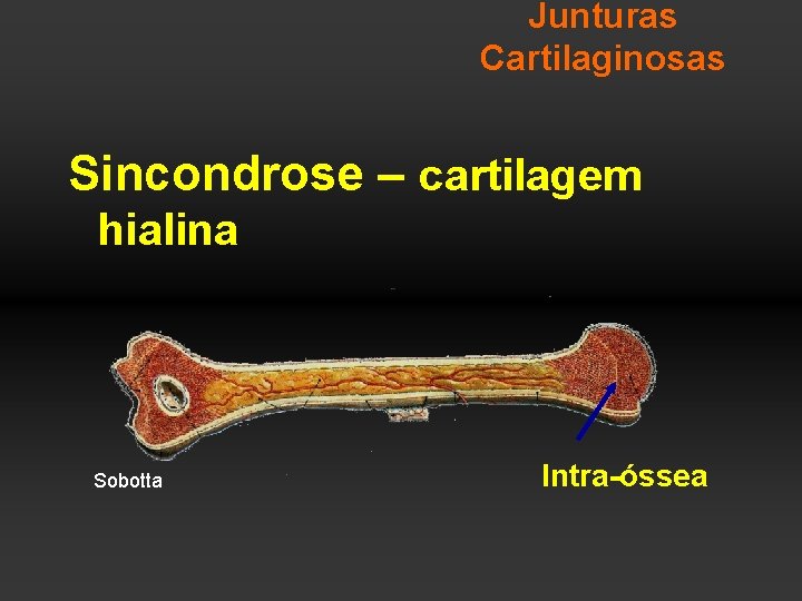 Junturas Cartilaginosas Sincondrose – cartilagem hialina Sobotta Intra-óssea 