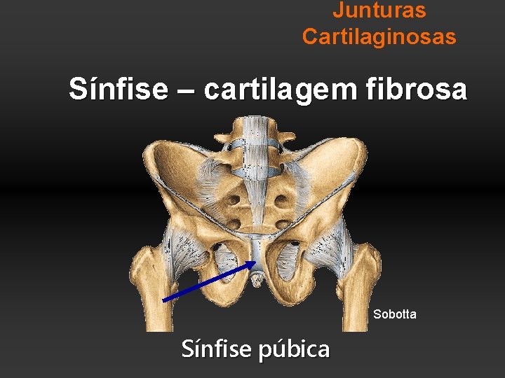 Junturas Cartilaginosas Sínfise – cartilagem fibrosa Sobotta Sínfise púbica 