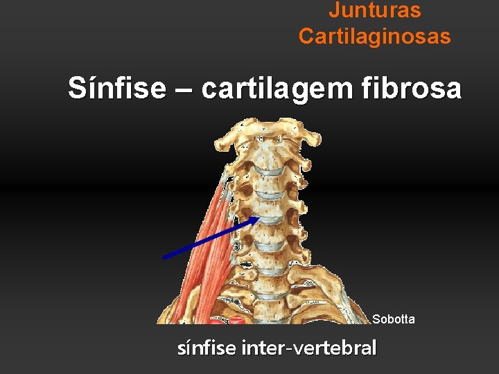 Junturas Cartilaginosas Sínfise – cartilagem fibrosa Sobotta sínfise inter-vertebral 