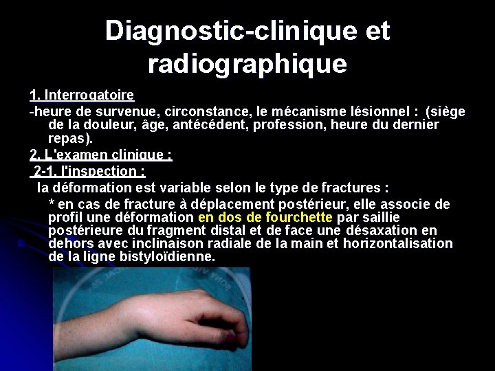 Diagnostic-clinique et radiographique 1. Interrogatoire -heure de survenue, circonstance, le mécanisme lésionnel : (siège